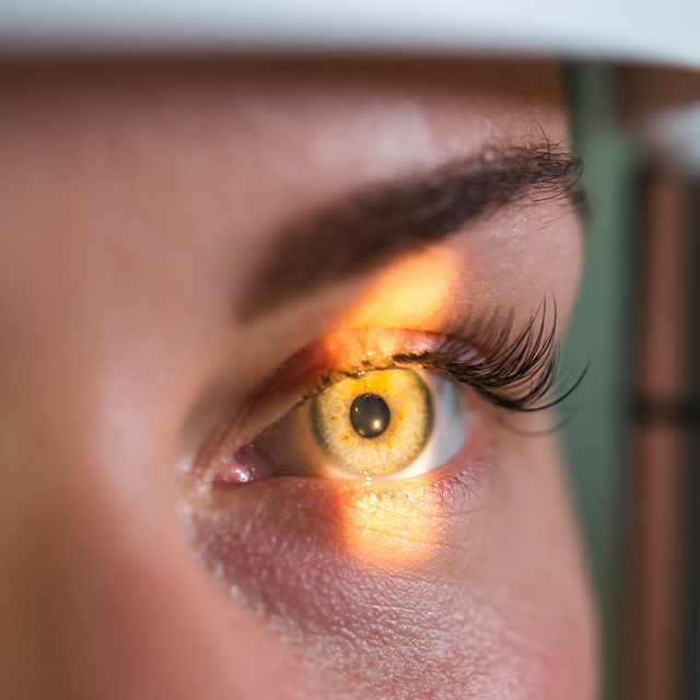 Vision Therapy in St. Augustine